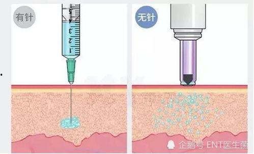 生长激素注射视频